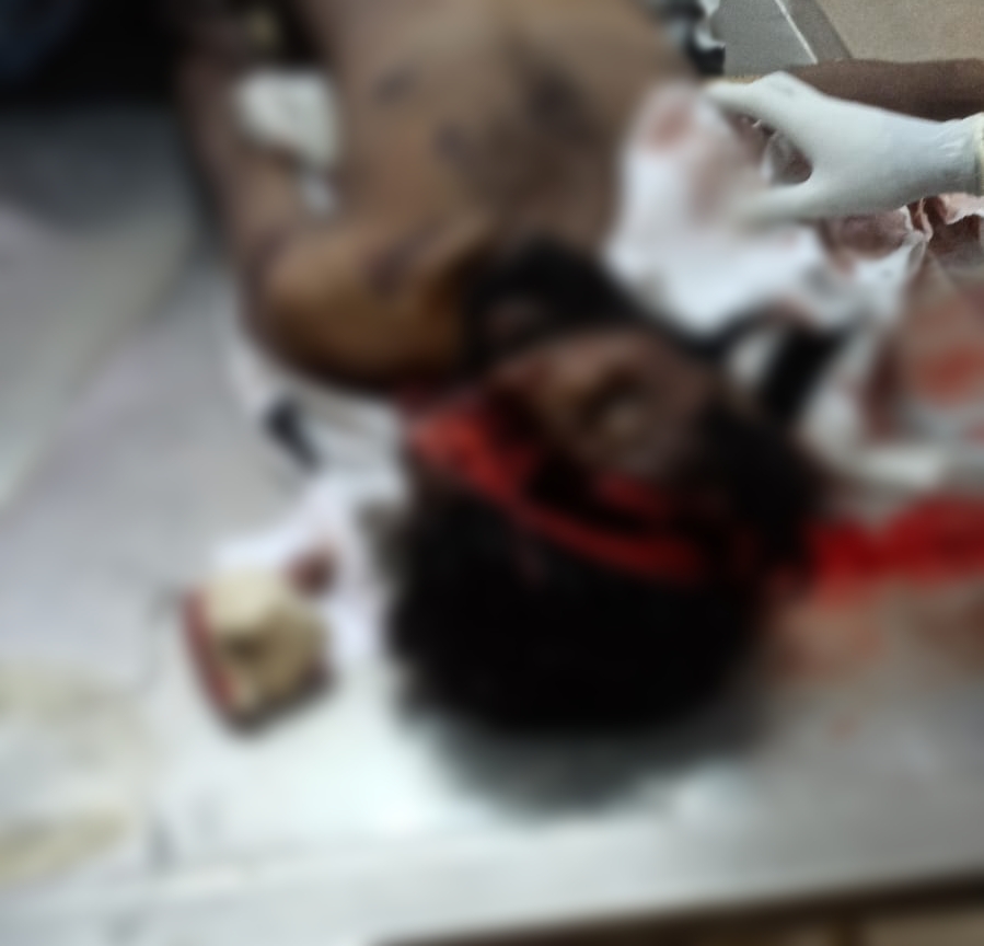 ಸೂರ್ಯಗ್ರಹಣದ ವೇಳೆ ಅಪಘಾತ…ಯುವತಿಯೊಂದಿಗೆ ತೆರಳುತ್ತಿದ್ದ ಯುವಕ ಸ್ಥಳದಲ್ಲೇ ಸಾವು…ಸ್ನೇಹಿತೆ ಗಂಭೀರ…ಇಲವಾಲದ ಬೀರಿಹುಂಡಿ ಬಳಿ ದುರಂತ…