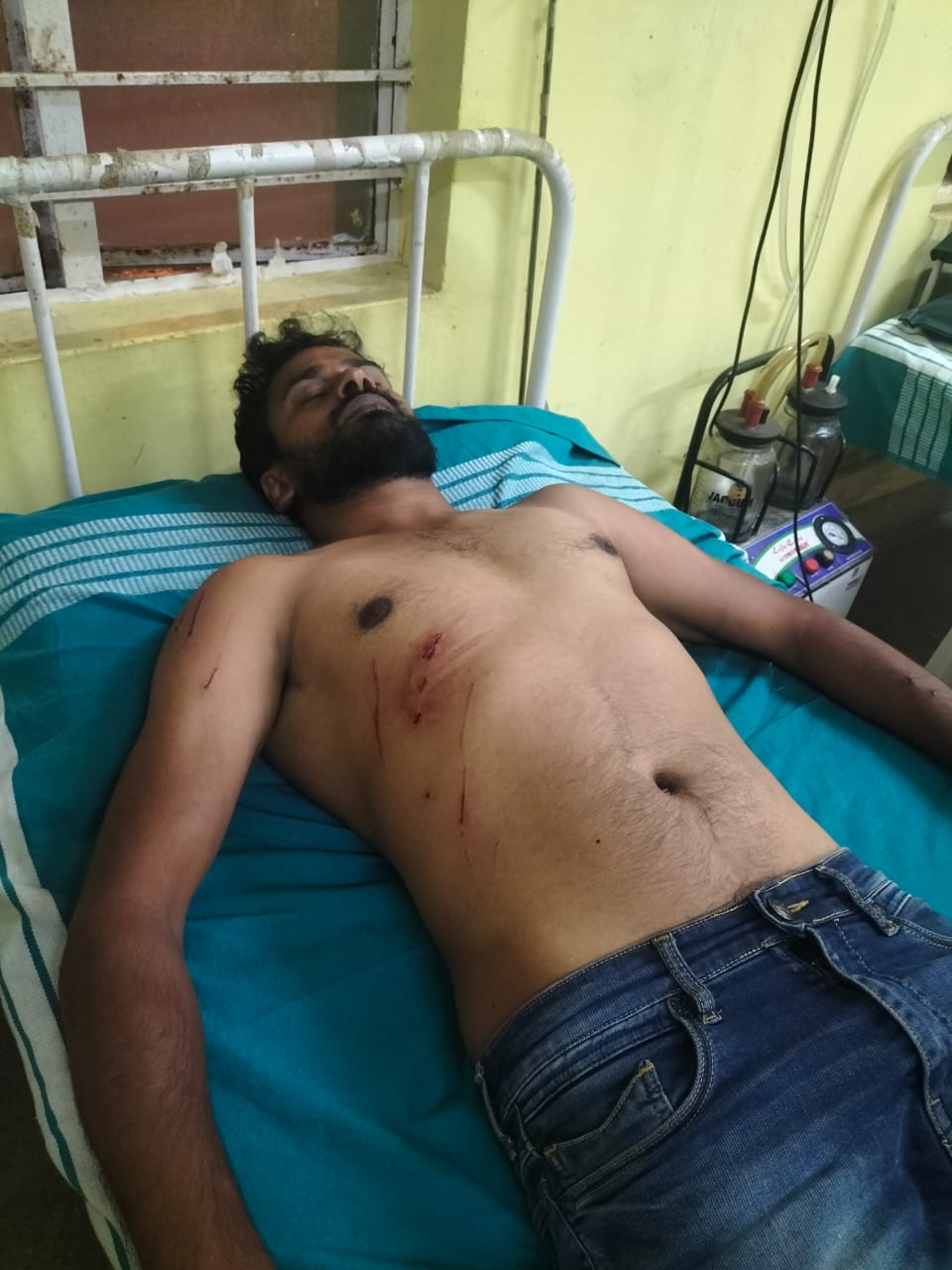 ಬನ್ನೂರಿನಲ್ಲಿ ಮತ್ತೆ ಚಿರತೆ ದಾಳಿ…ಯುವಕನಿಗೆ ಗಾಯ…ಪ್ರಾಣಾಪಾಯದಿಂದ ಪಾರು…