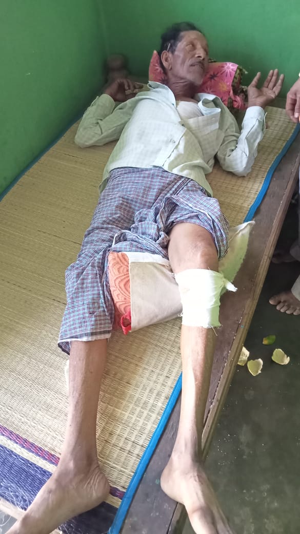 ಕಾಡು ಹಂದಿ ದಾಳಿ…ಗಾಯಗೊಂಡ ರೈತ…