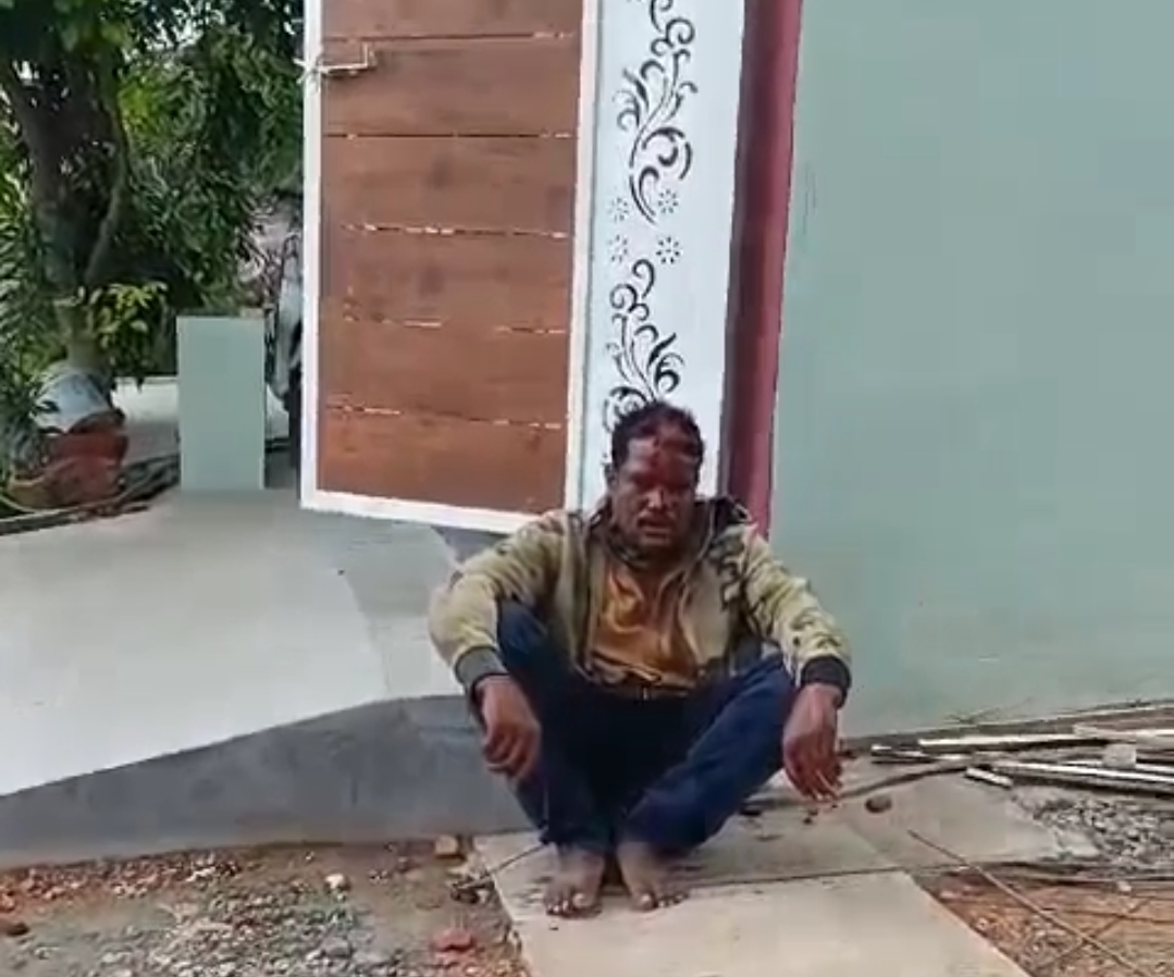 ಅನ್ನ ಹಾಕಿದ ಮನೆಗೆ ಖನ್ನ…ಮಹಡಿಯಿಂದ ಜಿಗಿದು ಗಾಯಗೊಂಡ ಕಳ್ಳ…