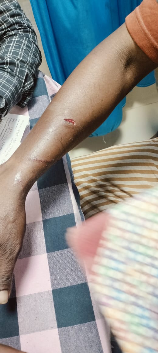 ರೈತನ ಮೇಲೆ ಚಿರತೆ ದಾಳಿ…ಆಸ್ಪತ್ರೆಗೆ ದಾಖಲು…