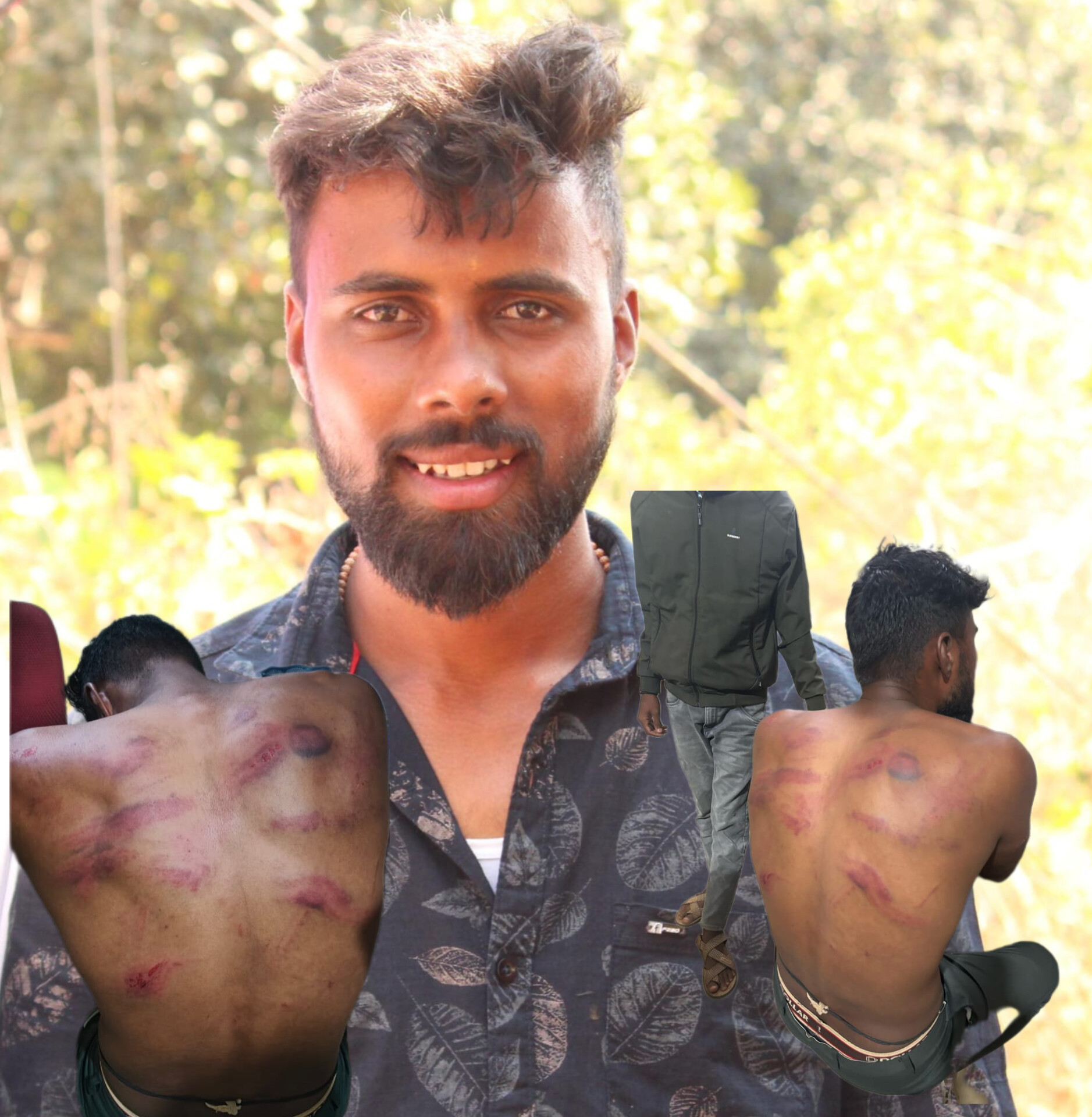 ಹಳೆ ದ್ವೇಷ…ಬೈಕ್ ಅಡ್ಡಗಟ್ಟಿ ಯುವಕನ ಮೇಲೆ ಮಾರಣಾಂತಿಕ ಹಲ್ಲೆ…