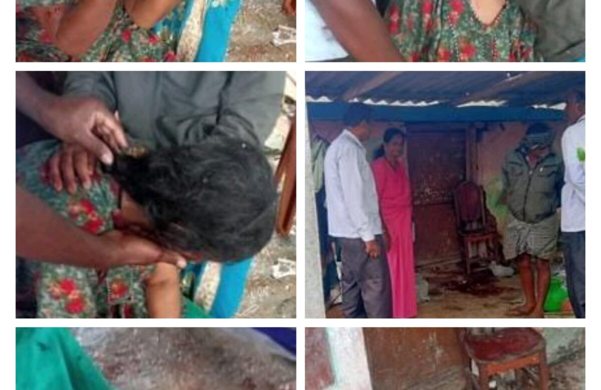 ಸಿಡಿಮದ್ದು ಸ್ಪೋಟ…ಮಹಿಳೆಗೆ ಗಾಯ…ಕವರ್ ಓಪನ್ ಮಾಡಿದಾಗ ಘಟನೆ…