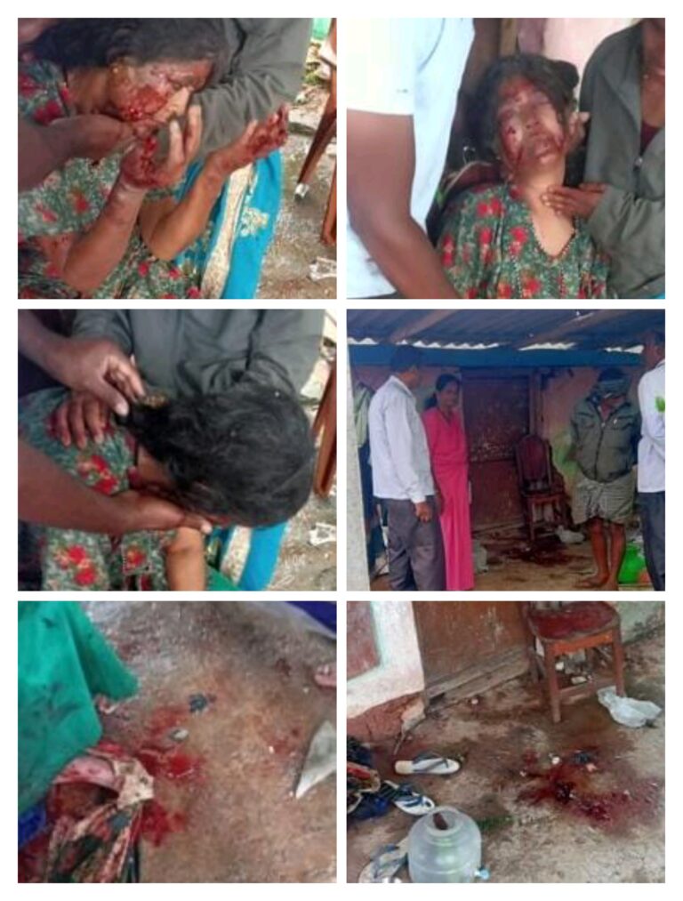 ಸಿಡಿಮದ್ದು ಸ್ಪೋಟ…ಮಹಿಳೆಗೆ ಗಾಯ…ಕವರ್ ಓಪನ್ ಮಾಡಿದಾಗ ಘಟನೆ…