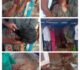 ಸಿಡಿಮದ್ದು ಸ್ಪೋಟ…ಮಹಿಳೆಗೆ ಗಾಯ…ಕವರ್ ಓಪನ್ ಮಾಡಿದಾಗ ಘಟನೆ…