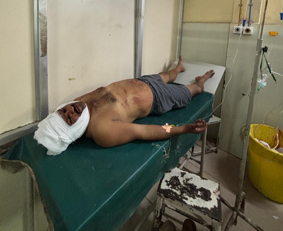 ಅಕ್ರಮ ವಿದ್ಯುತ್ ಸಂಪರ್ಕ ಪ್ರಶ್ನಿಸಿದ್ದೇ ತಪ್ಪಾಯ್ತು…ಮೀಟರ್ ರೀಡರ್ ಮೇಲೆ ರೌಡಿಶೀಟರ್ ನಿಂದ ಮಾರಣಾಂತಿಕ ಹಲ್ಲೆ…